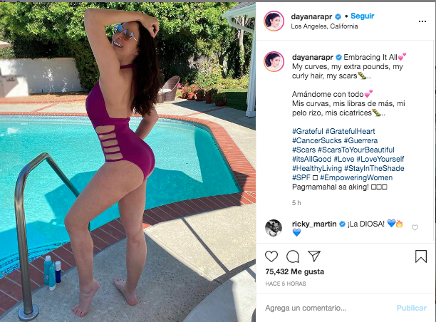 Dayanara Torres mostró su cicatriz que le provocó el cáncer de piel y que venció en marzo de este año.