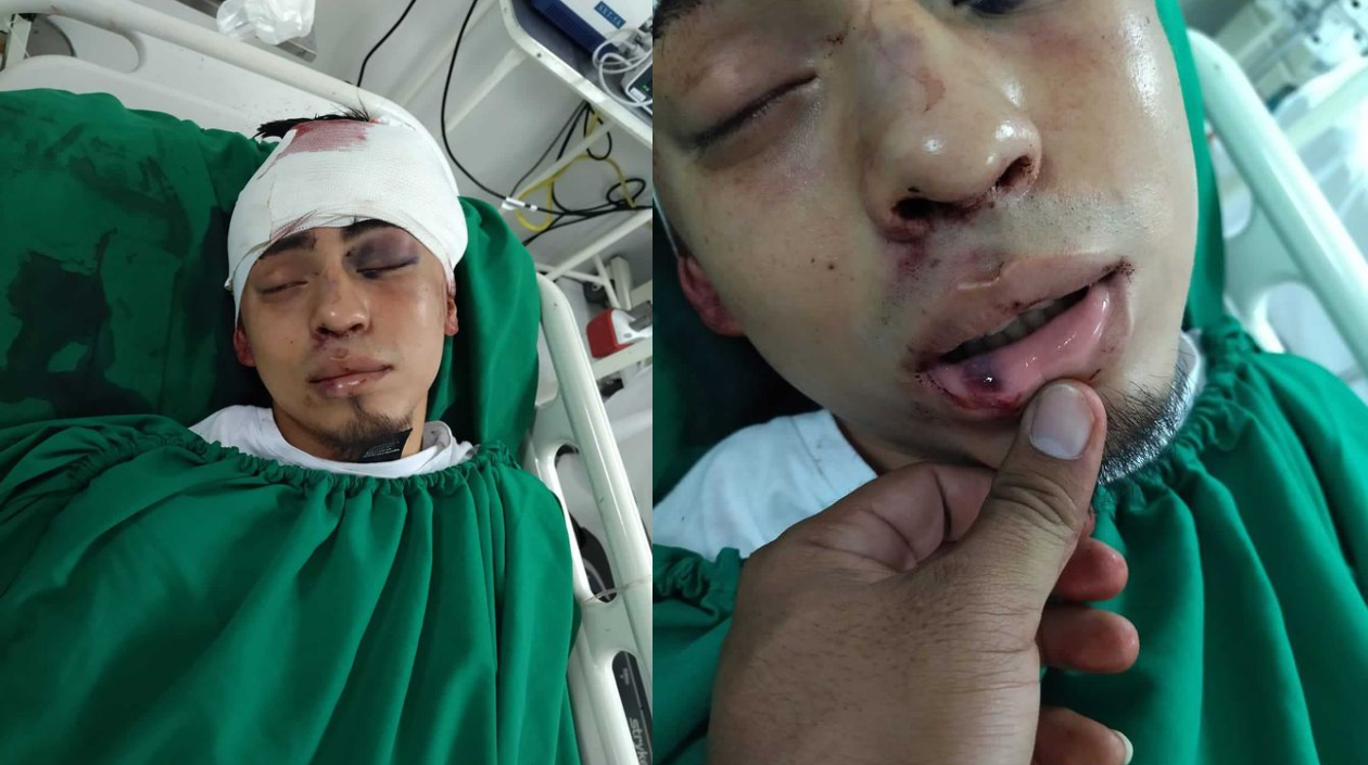 Joven herido por ataque de barristas.