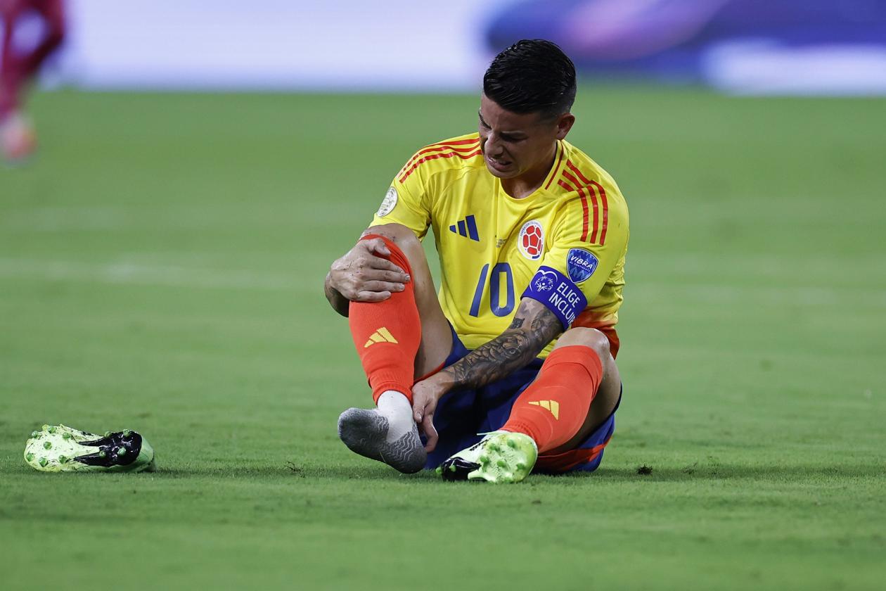 James Rodríguez adolorido en el campo de juego.