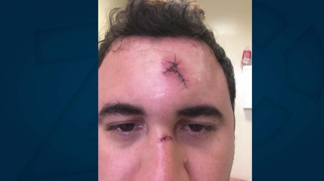 El hombre resultó herido en la frente.