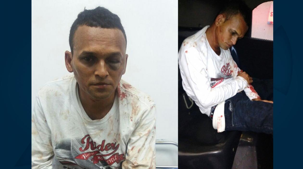 Dionar Federico Simanca Acendra, capturado tras los hechos.