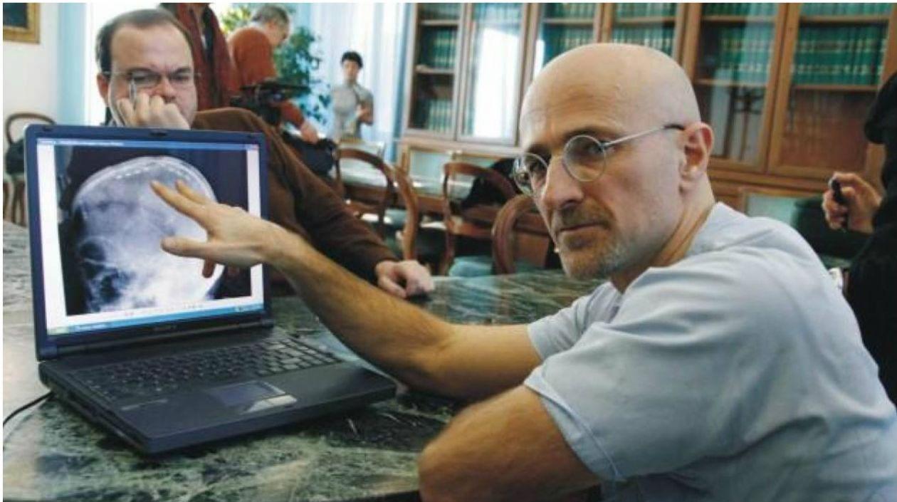 Sergio Canavero, neurocirujano italiano.