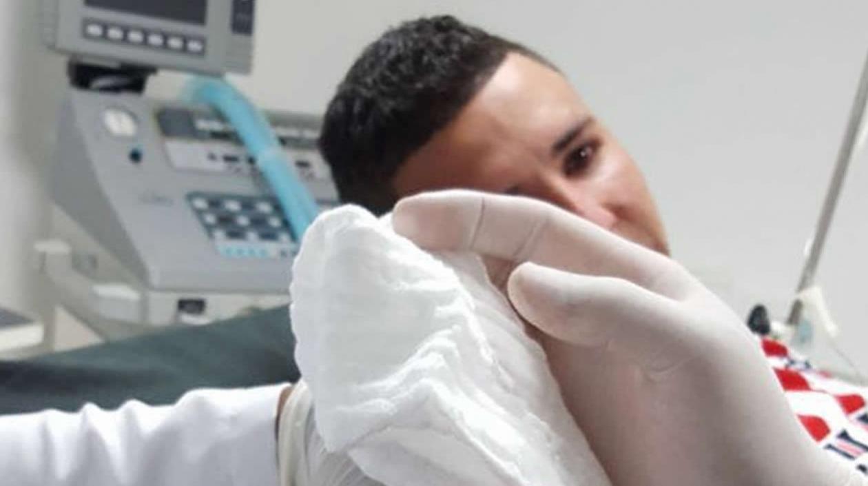 A Leuvis Morales le amputaron sus dedos índice y pulgar de su mano derecha