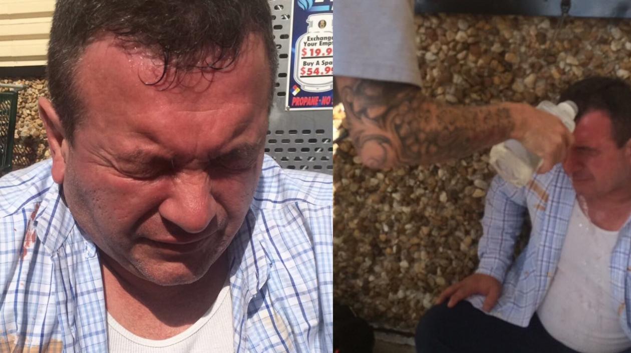 Mario Gallo, el hombre lesionado.