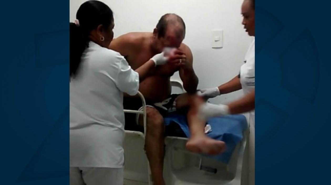 Ciudadano herido en medio de la golpiza al ladrón.