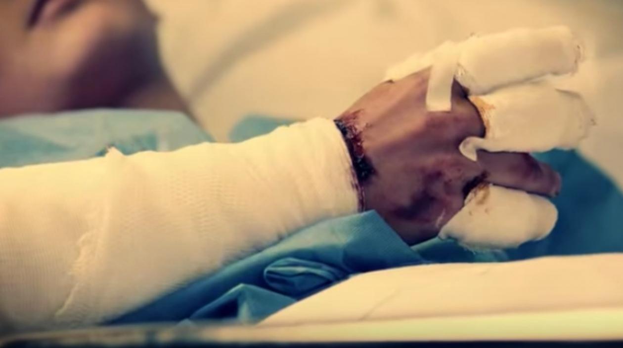 Seis adultos resultaron quemados la noche de velitas.