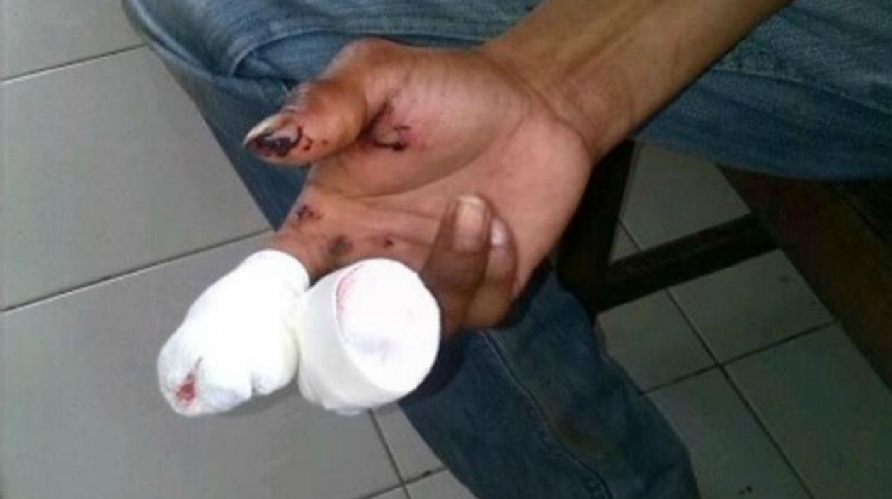 Los dos adultos quemados no tuvieron heridas de gravedad.