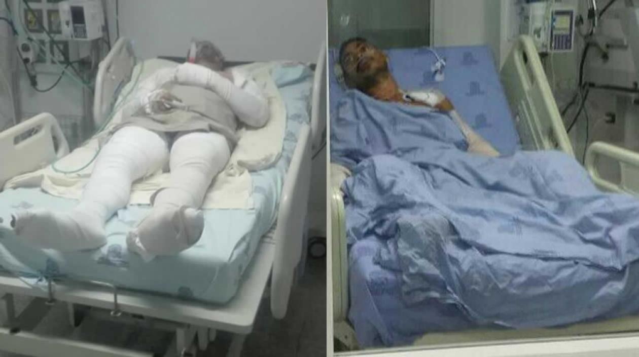 Álvaro Solano, interno que intentó suicidarse, y Francisco Acosta  recluso quemado.