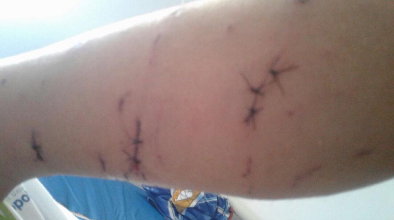 Así quedó el brazo del menor.