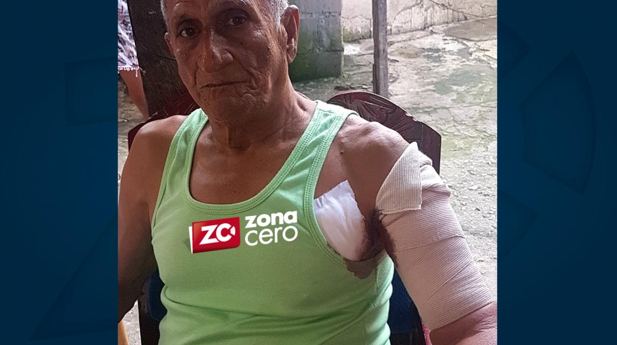 El hombre de la tercera edad fue dado de alta hoy al mediodía.