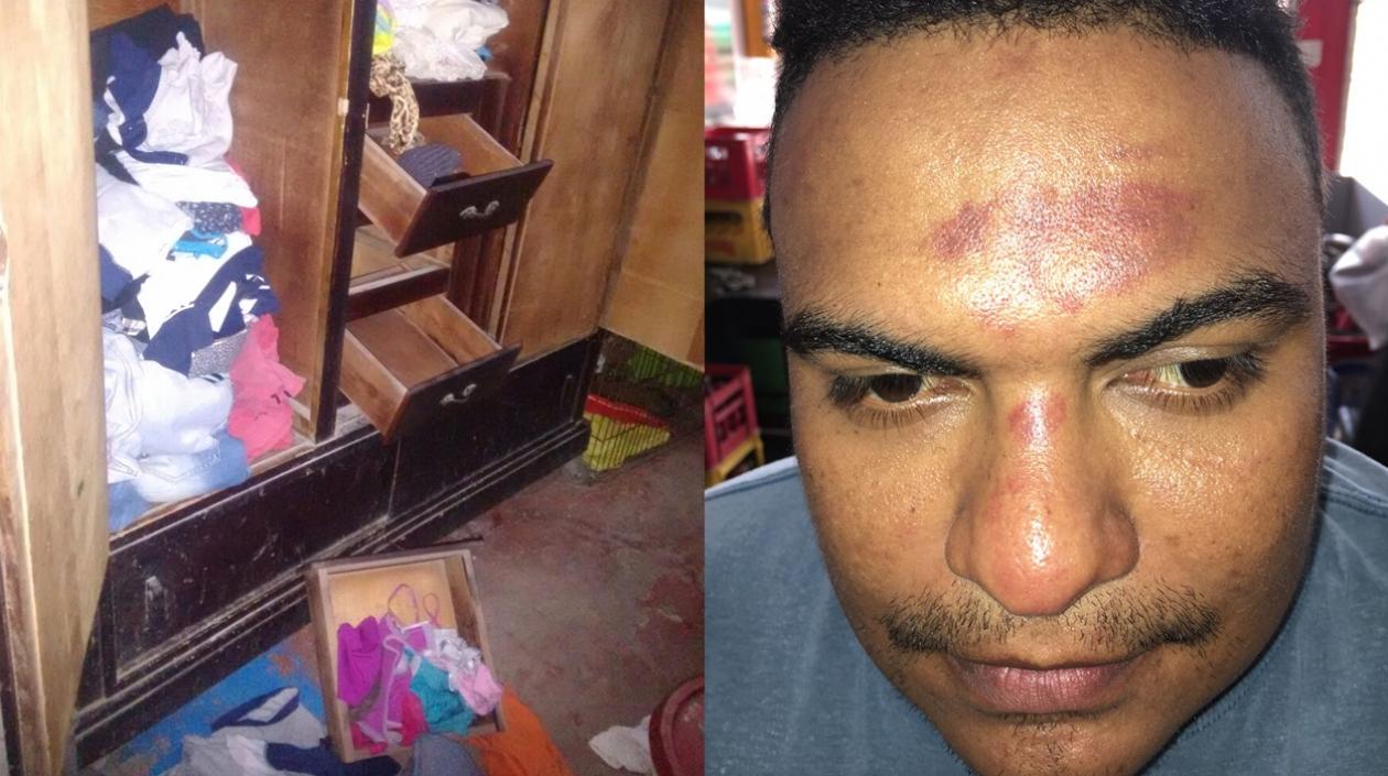 Ronny Montenegro Romero denunció haber sido golpeado por la Policía