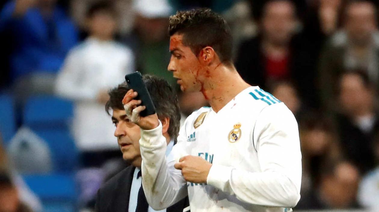 Cristiano Ronaldo terminó con una herida al marcar un gol. 