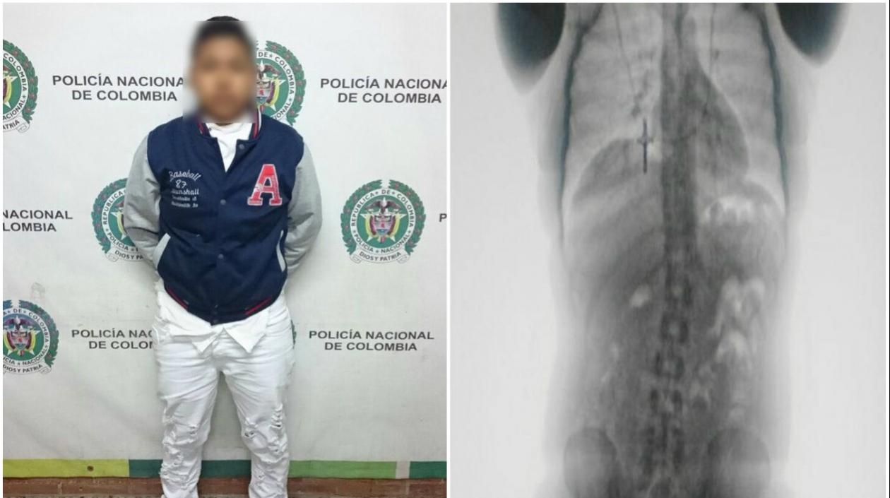 Capturada y radiografía que muestra las cápsulas.