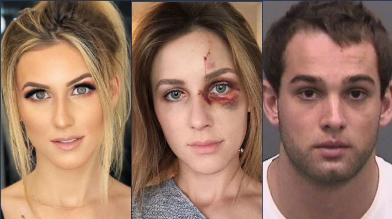 Modelo brasileña fue agredida por su novio, quien ahora la demanda por difamación.