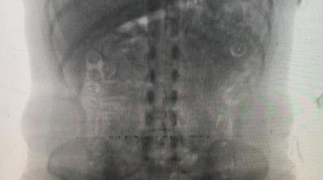 La mujer se enfermó durante el viaje y esto alertó a la Policía.