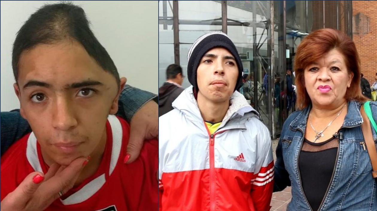 Harry Estiven Rodríguez, de 22 años. Se recupera de las fracturas que sufrió a manos de hinchas rivales.