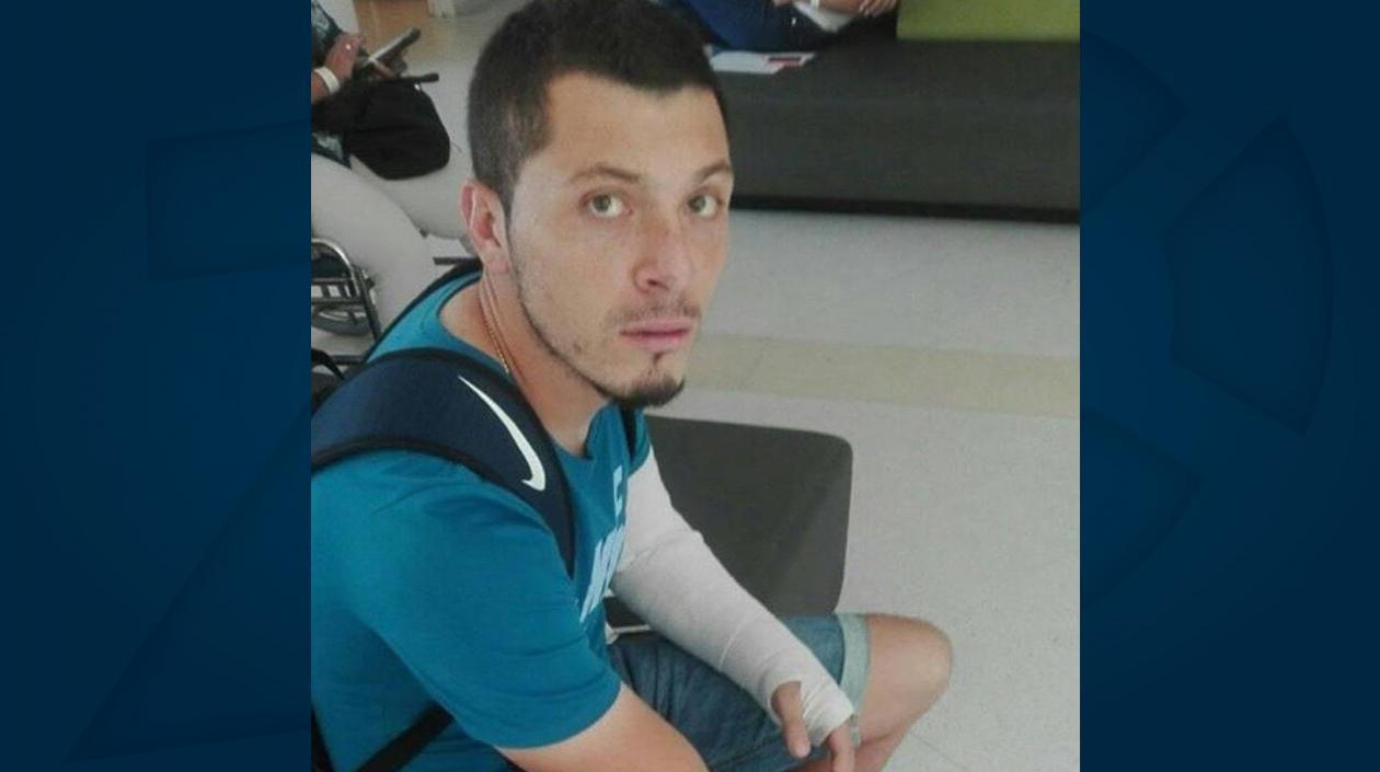 Leonardo Pico se fracturó el brazo izquierdo. 