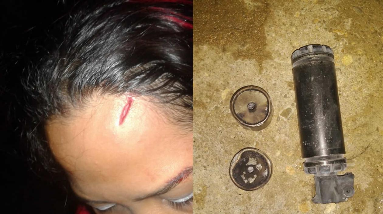 A la izquierda, la esposa del joven detenido resultó herida en la frente. A la derecha, gases lacrimógenos que fueron lanzados por la Policía. 