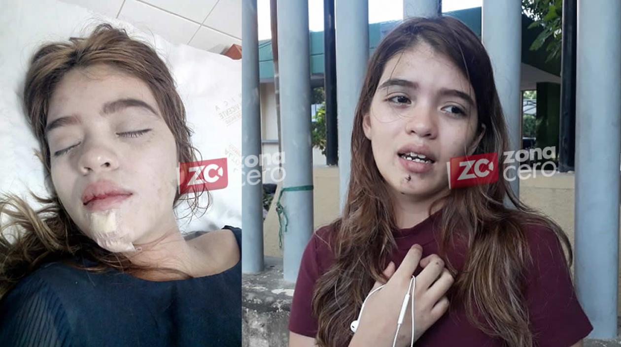 Jessica Mariel Barrios Tapia, con las lesiones recibidas.