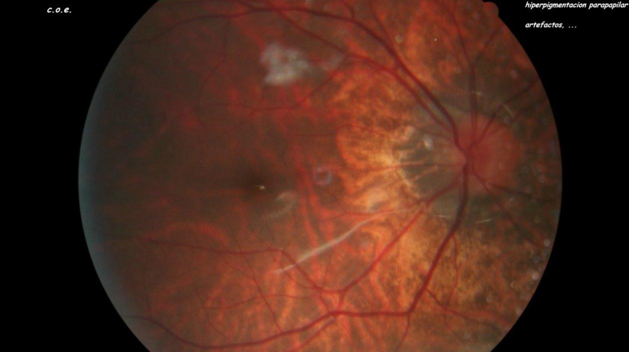  Investigadores desarrollaron una nueva herramienta basada en inteligencia artificial.