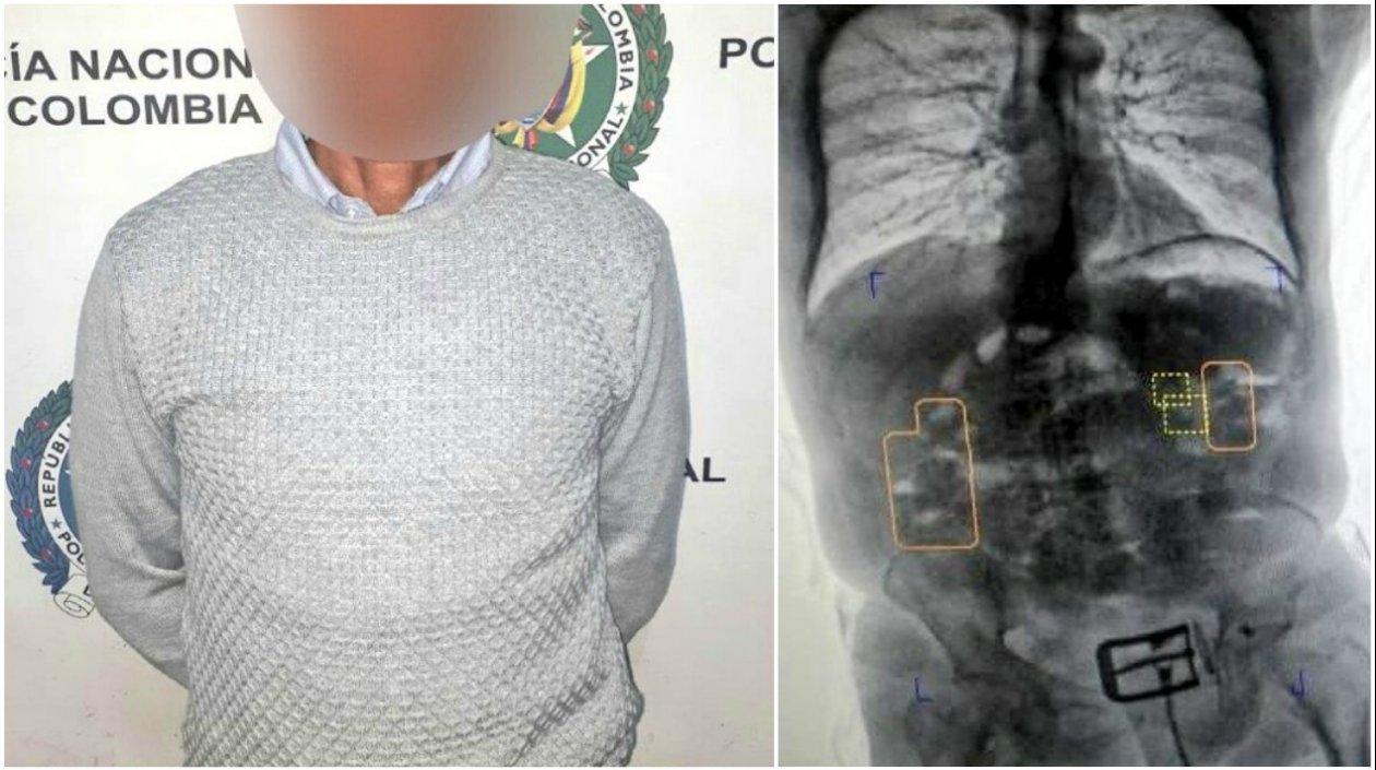 El anciano capturado transportaba más de 1 kilo de clorhidrato de cocaína en su estómago.