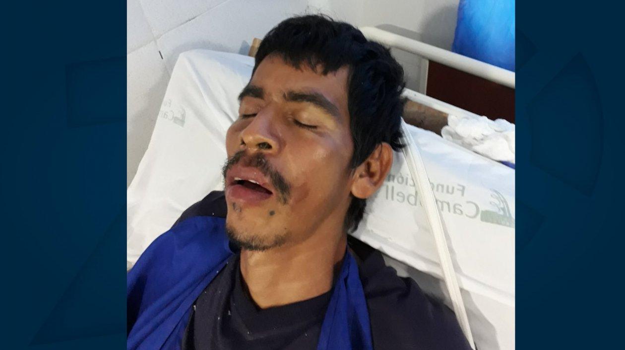 Así luce el hombre en la Clínica Campbell.