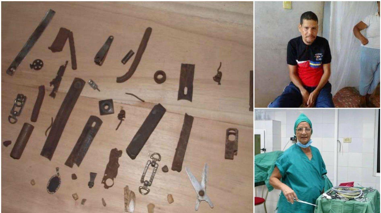 Leosbani P.L. fue el hombre que ingirió estos objetos. 