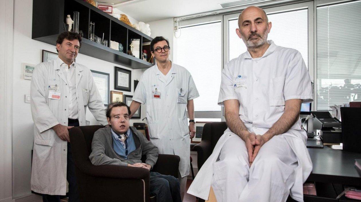 Médicos y paciente con rostro trasplantado.