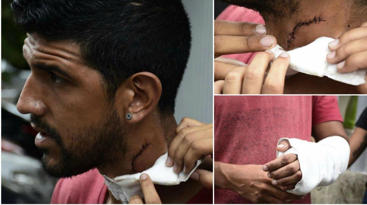 Reiner Hurtado, venezolano herido.