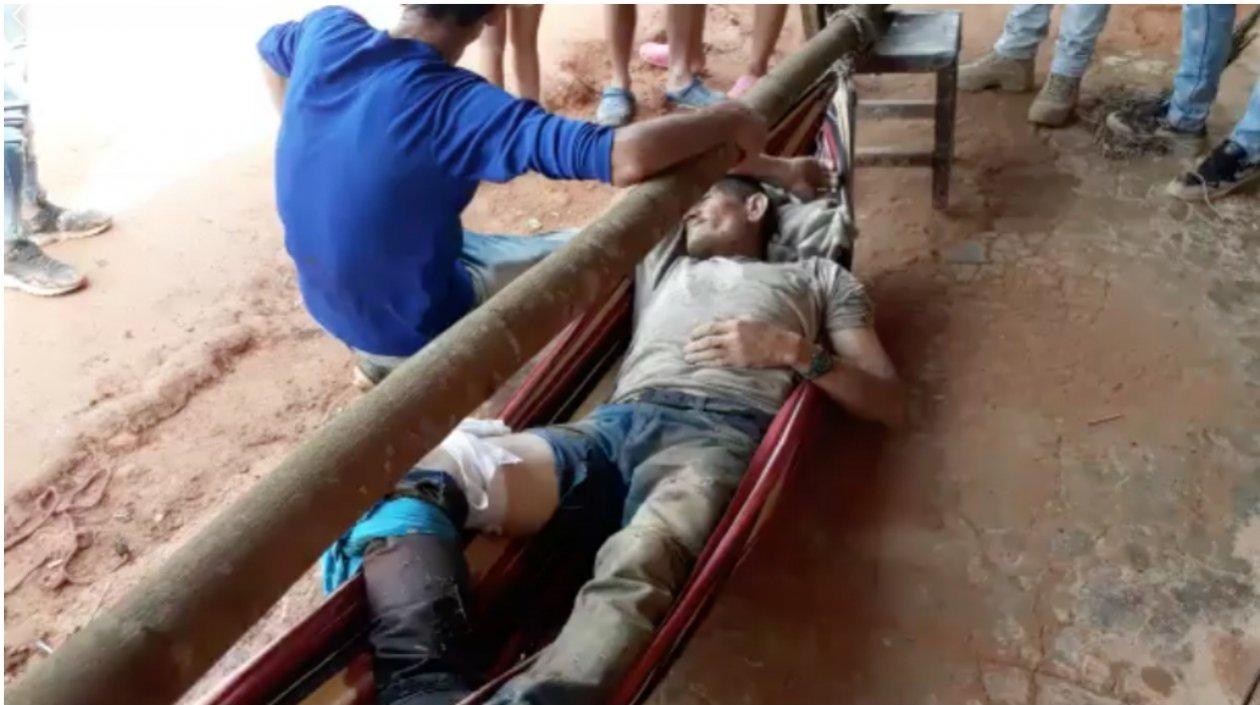 Said Carrascal, víctima de mina antipersona en zona rural de San Calixto.