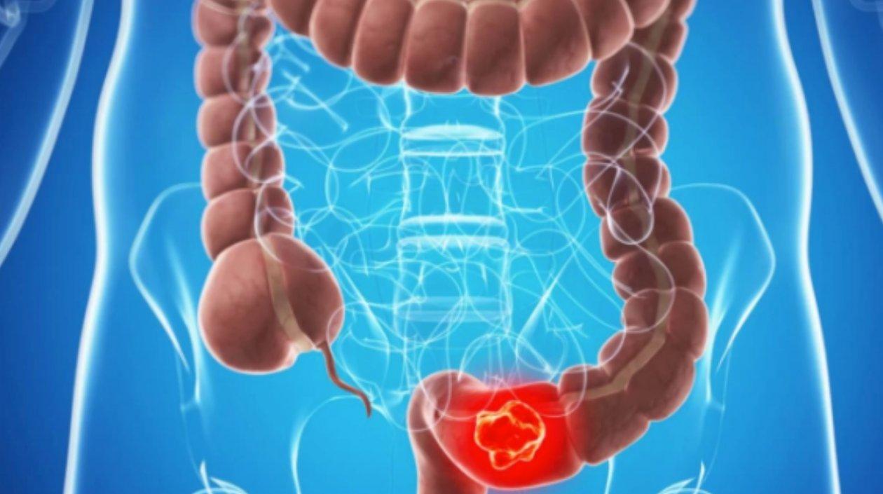  El estudio también podría allanar el camino para el desarrollo de nuevas terapias.