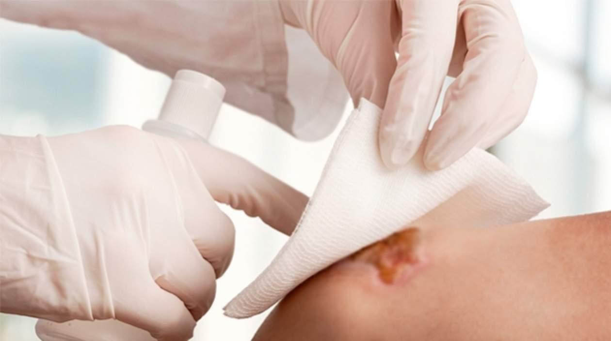 Podría aplicarse internamente en órganos afectados.