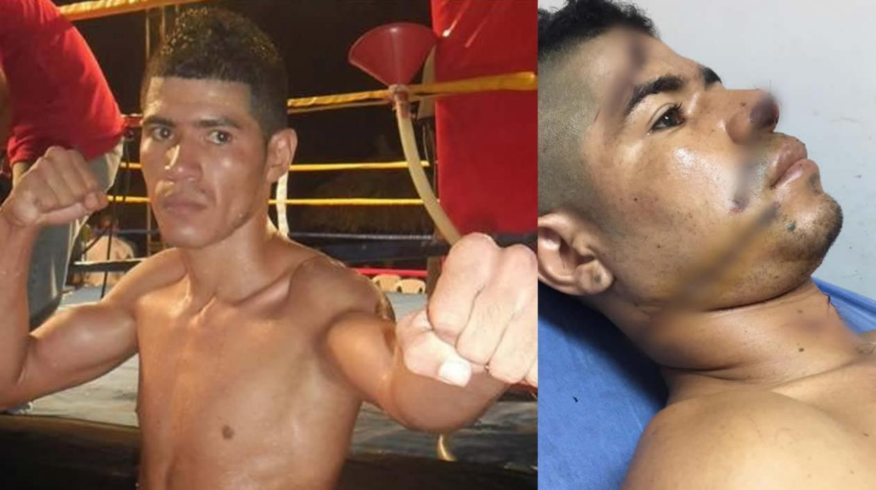 Boxeador colombiano Luis Flórez. 