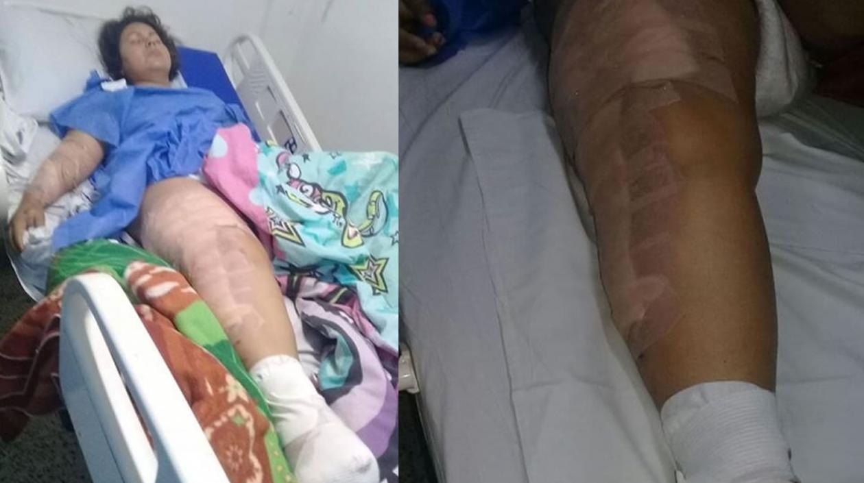 Johana y su familia pide una pronta solución a su EPS Medimás.