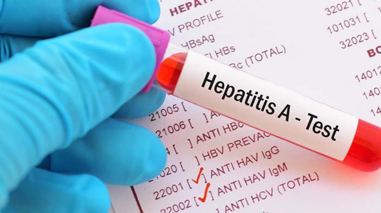 Muestras están en procesamiento por parte del Laboratorio de Salud Pública de Magdalena.