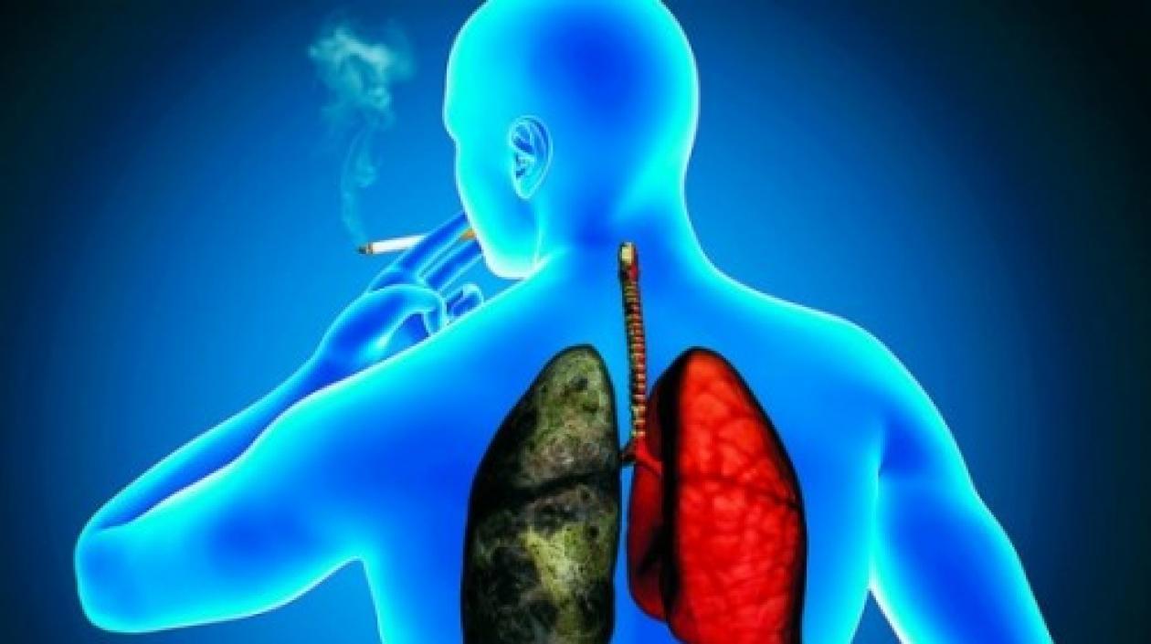 El 80 % de los pacientes de cáncer de pulmón sobreviven menos de dos años.