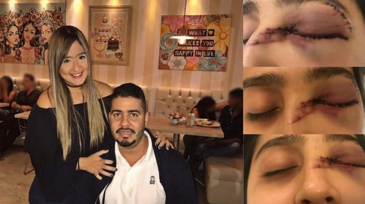 Daniela junto a su esposo e imágenes  de como le quedó el rostro tras la agresión. 