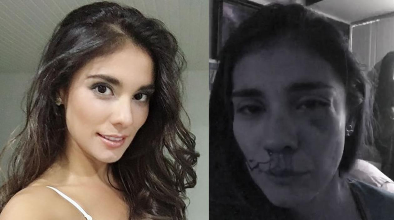 Así quedó el rostro de Eileen Moreno. 