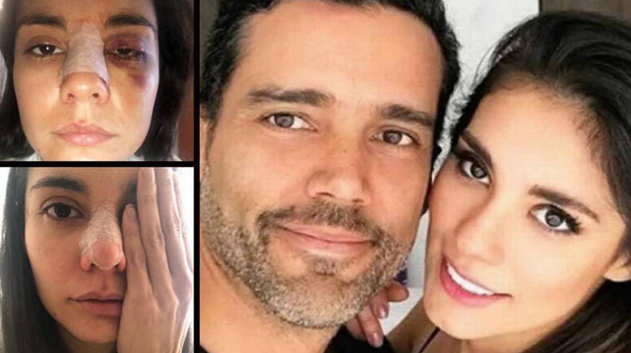 La actriz Eileen Moreno y el actor Alejandro García.