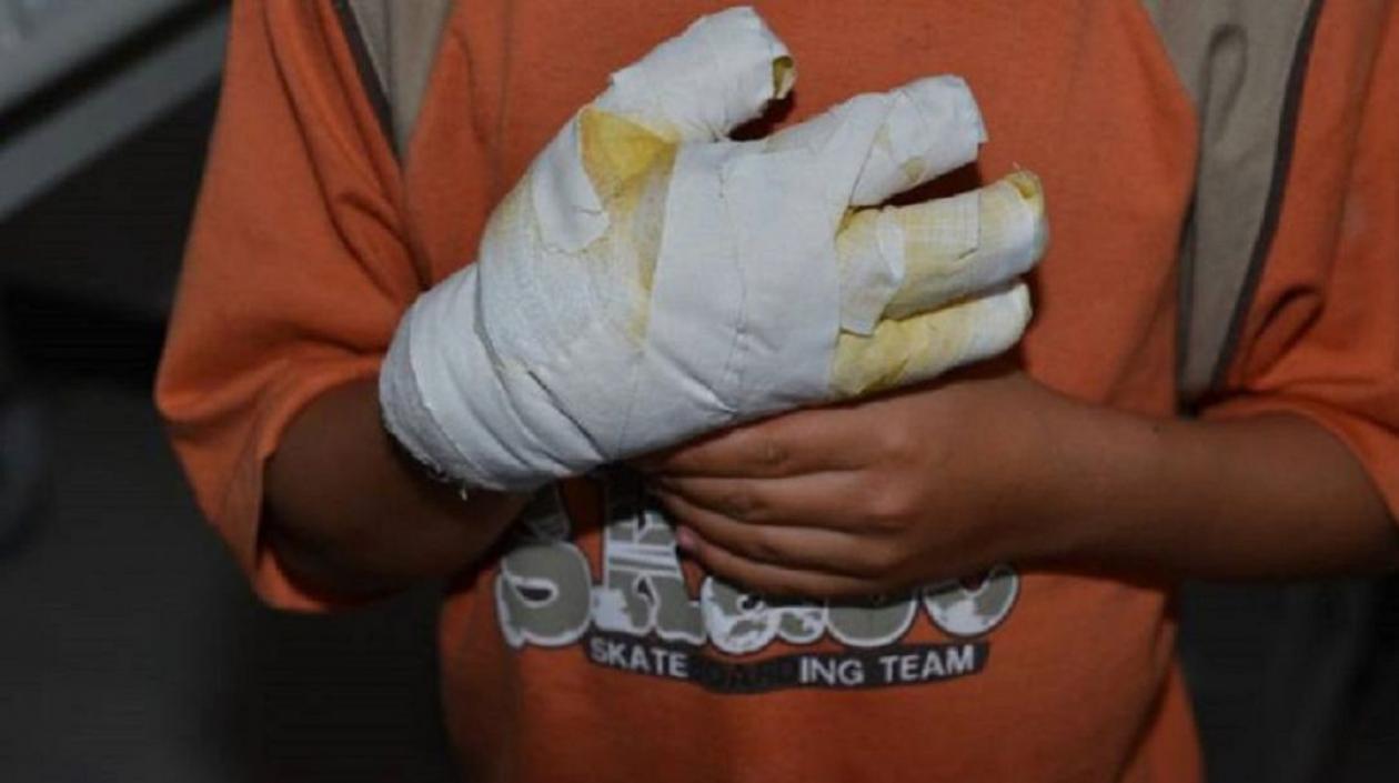 25 menores resultaron quemados con pólvora en Atlántico.