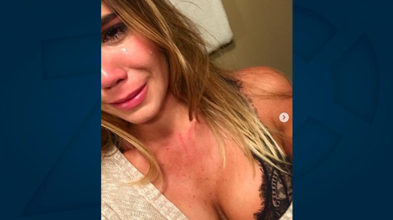 La modelo Estefanía Pereira mostrando la agresión.