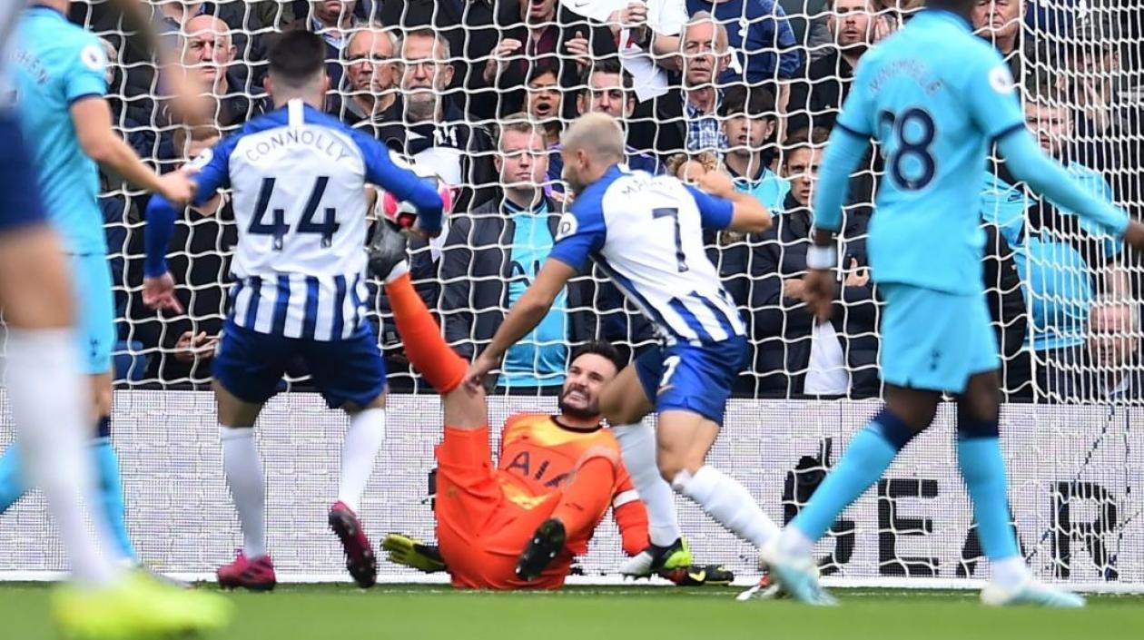 Hugo Lloris se fracturó el brazo en una caída. 