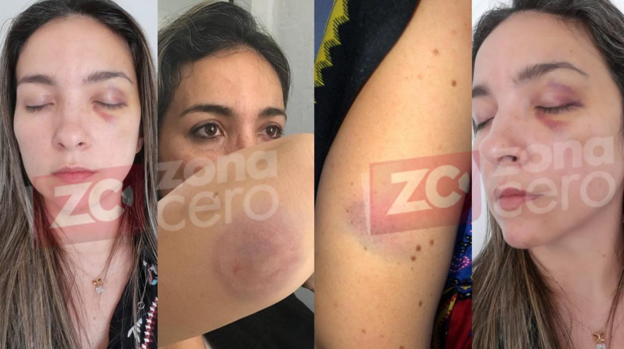 Las lesiones que sufrió Laura Isabel Navas Jaramillo.
