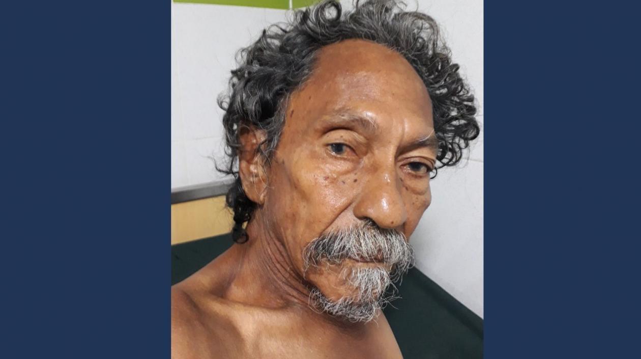 César Segundo Castro Castro, paciente que está siendo atendido en  la Fundación Campbell.