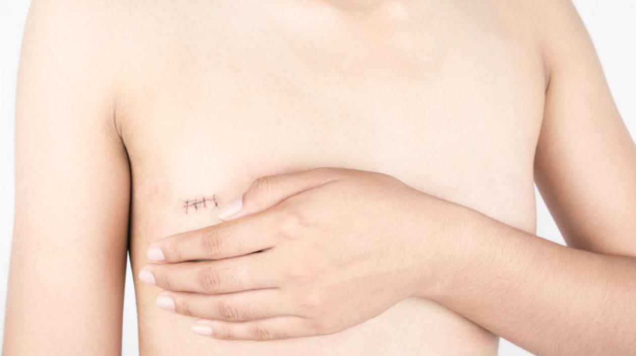 El cáncer es la principal causa de muerte en todo el mundo. 