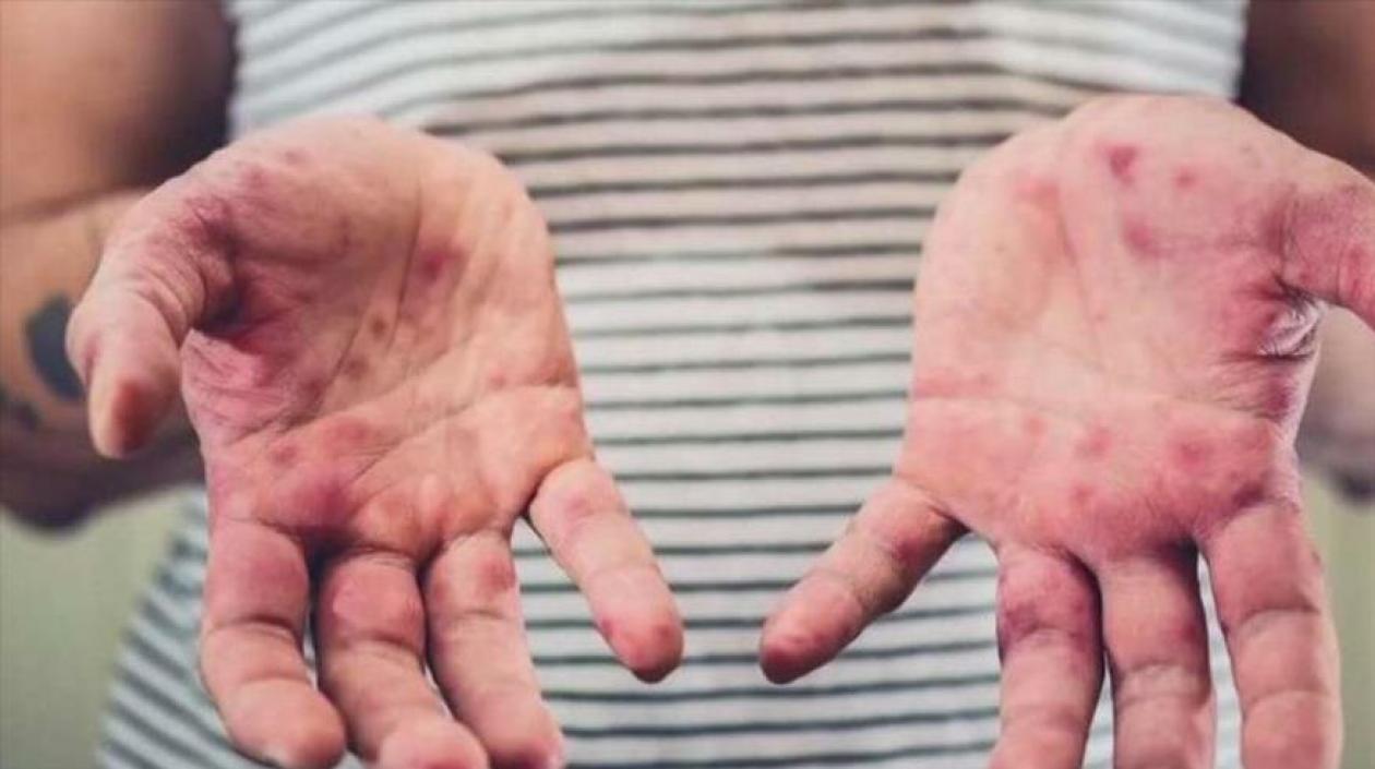 El número total de casos estimados en 2018 ascendió a 9,76 millones.