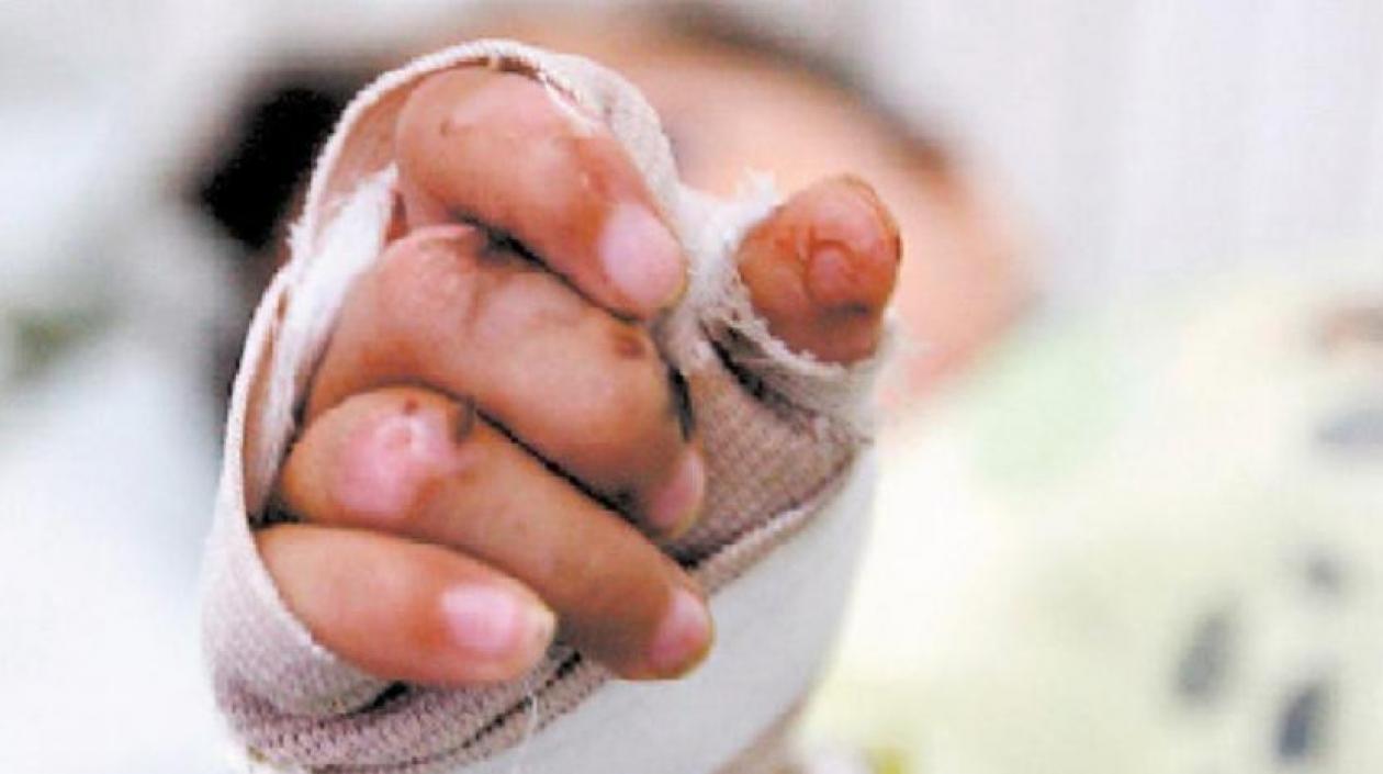 El año pasado cifra de la 'Noche de Velitas' llegó a 56 casos de quemados.