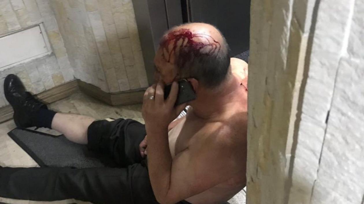 Este es el vigilante herido en los hechos en Bogotá.