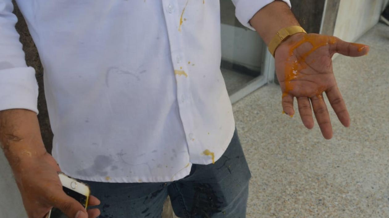 El periodista Heyner Escobar resultó agredido con un huevo