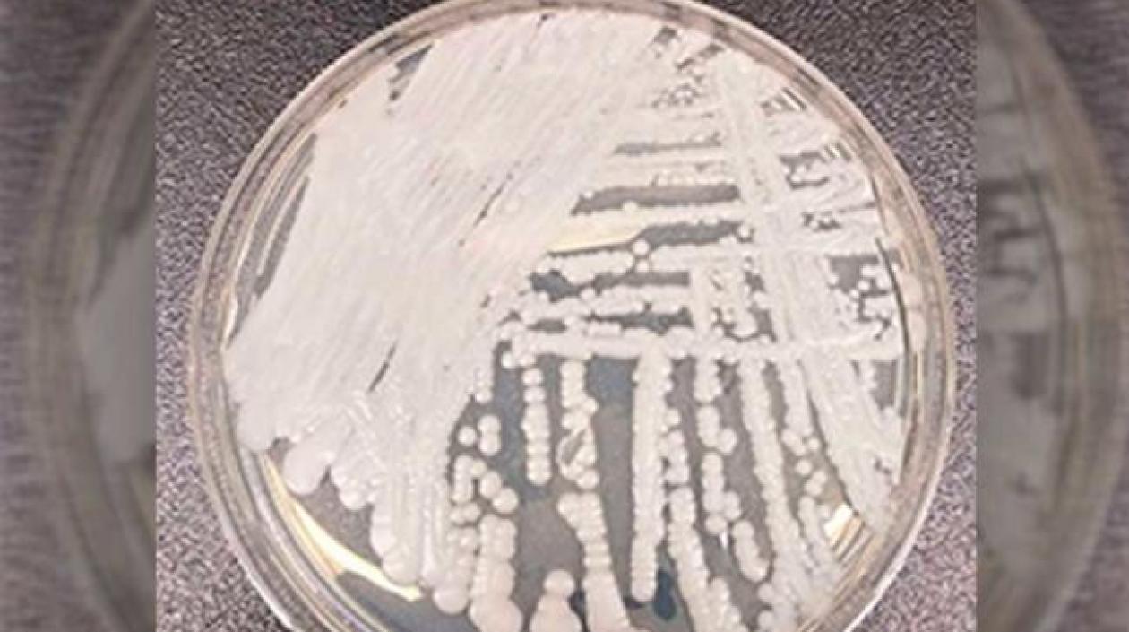 La Cándida auris apareció en 2015 y tiene vigilancia en Colombia desde el año 2016.